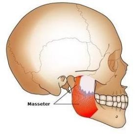 Esthetique Genève- Injections Botox - Anatomie Muscle Masseter